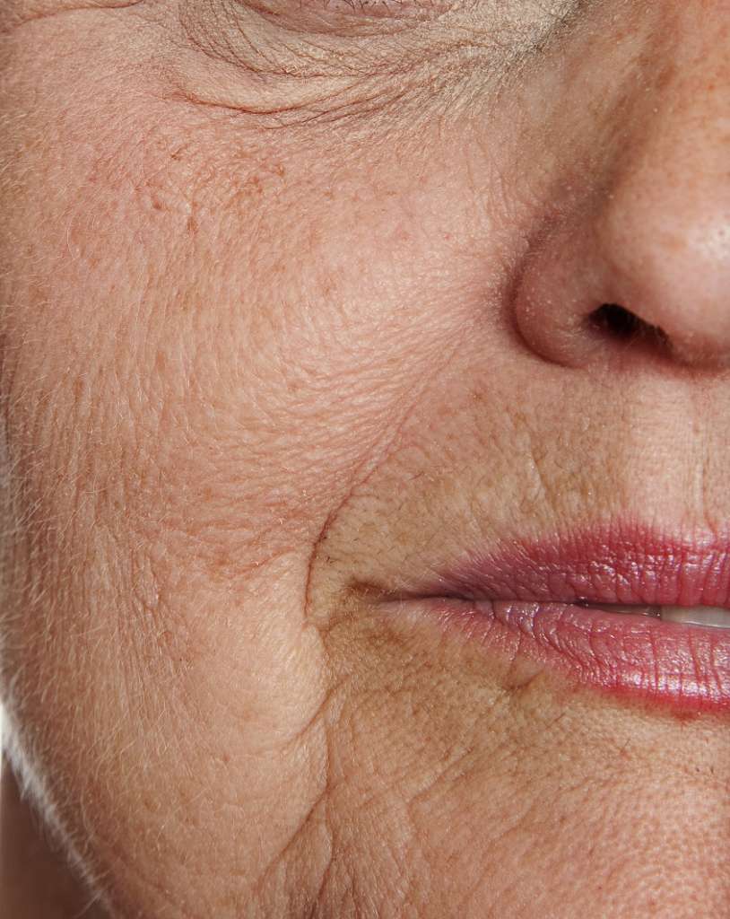 Anti-Aging Skincare