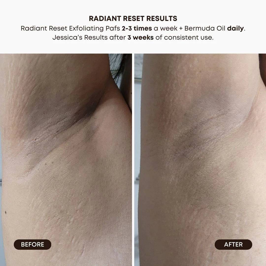 Radiant Reset Exfoliating Toner Pads